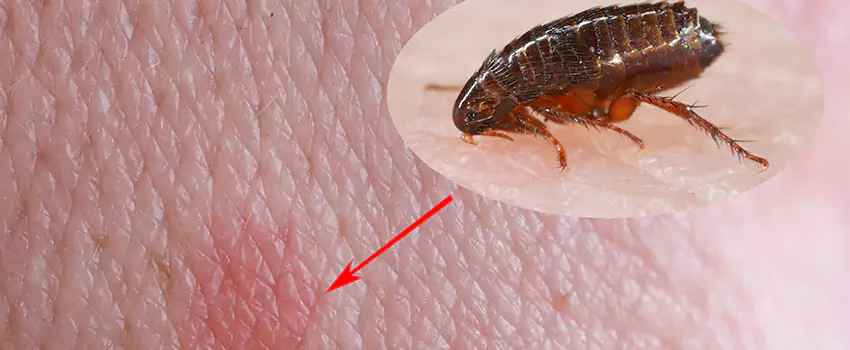 Flea Control for Humans Lawrenceville, GA